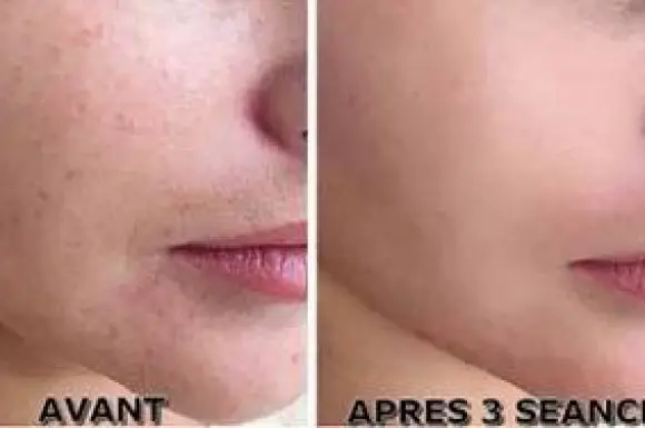 ItStyle Saint-Chamond - Soin du visage en Institut de beauté - 2