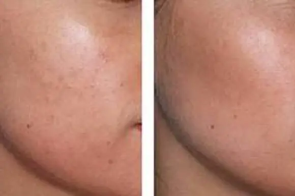 ItStyle Saint-Chamond - Soin du visage en Institut de beauté - 3